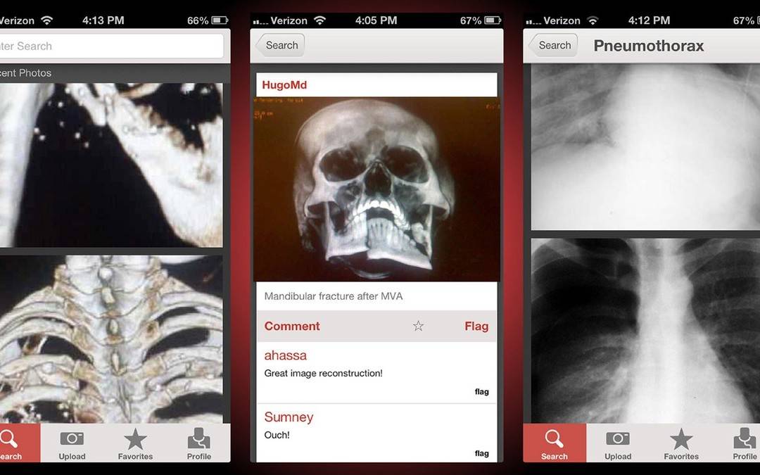 New “Instagram-like” photo sharing app for doctors